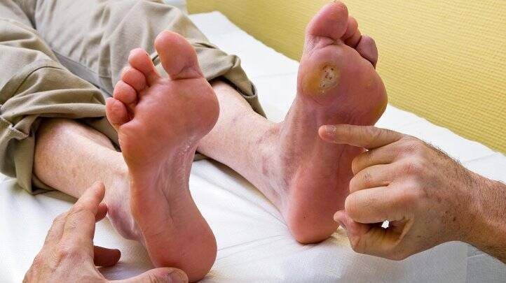 Diabetic Foot Surgery
