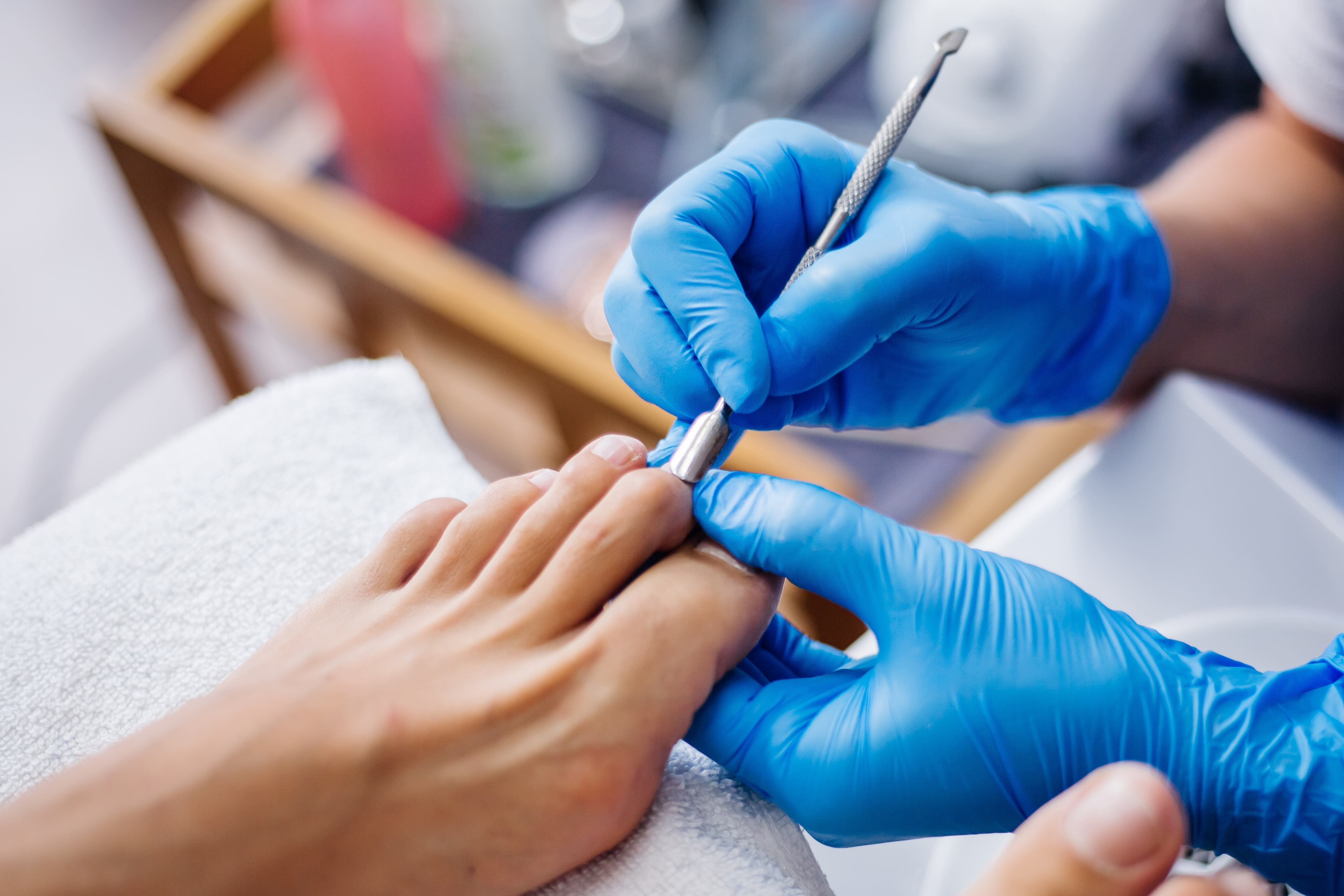 Ingrown Toenail Surgery